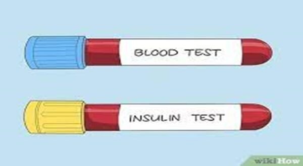 Quickdiagno INSULIN-RANDOM