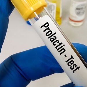 PROLACTIN