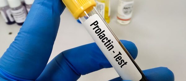 PROLACTIN