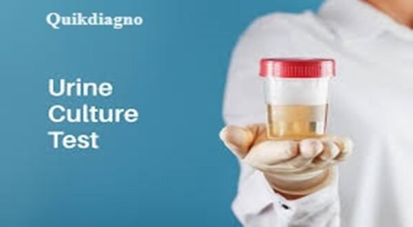 Quickdiagno URINE CULTURE
