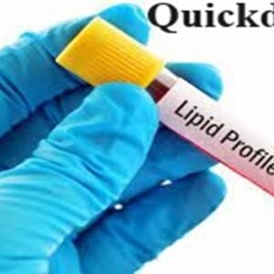 Quickdiagno lipid profile
