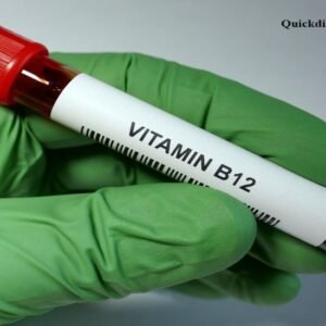 Quickdiagno vitamin-b12