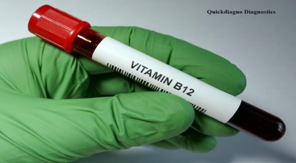 Quickdiagno vitamin-b12